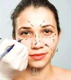 爆料整形诱导案例最新,最新案例警示录  第3张